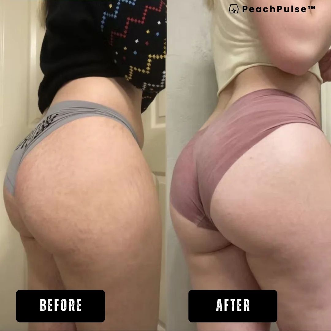 PeachPulse™